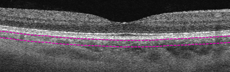 Figure 3