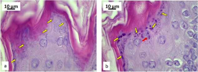 Figure 13