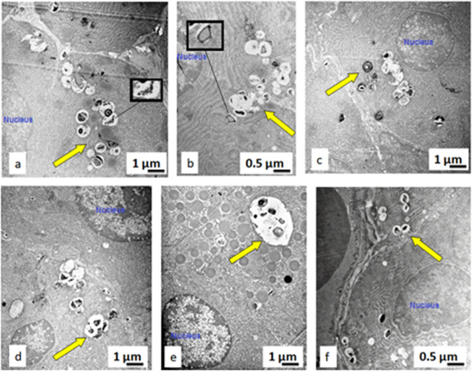 Figure 14