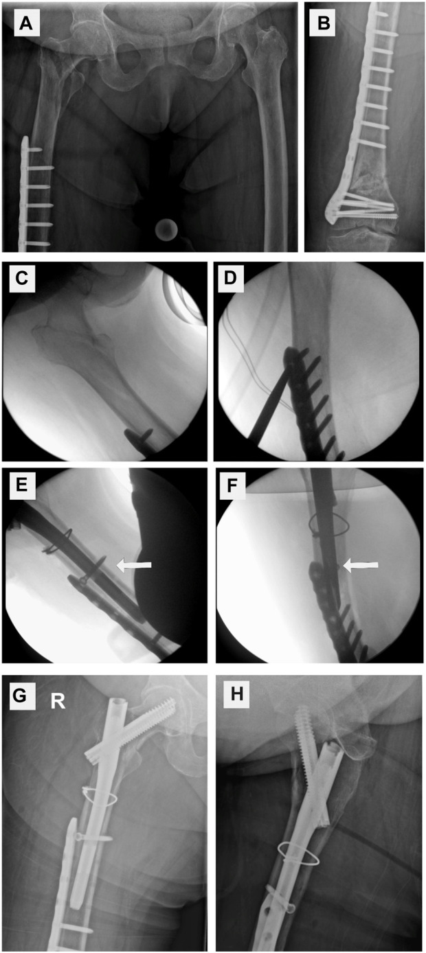 Figure 9