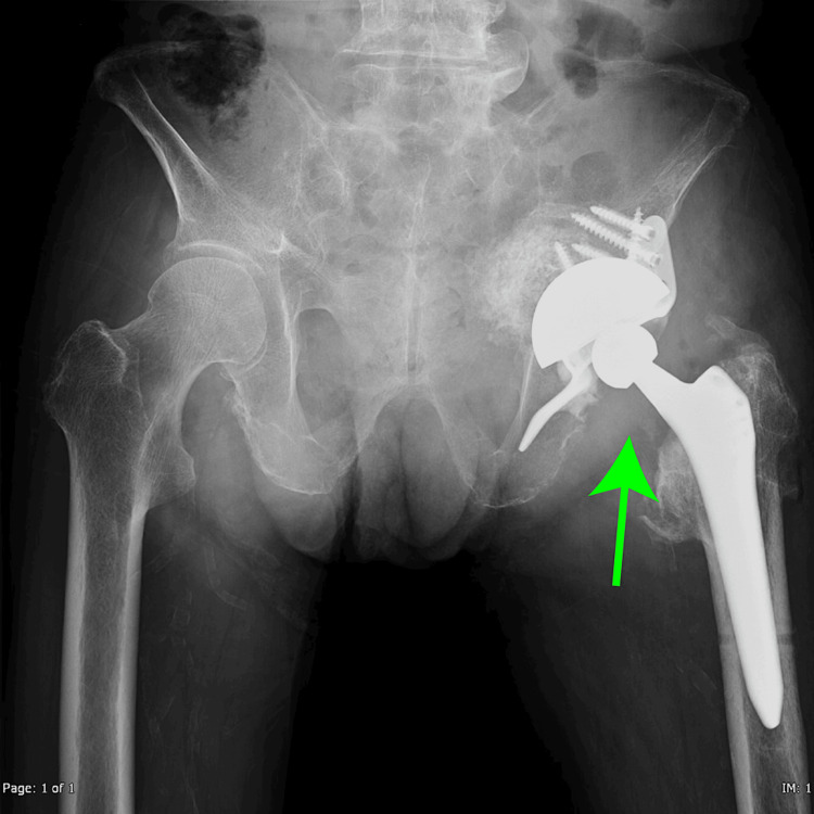 Figure 6