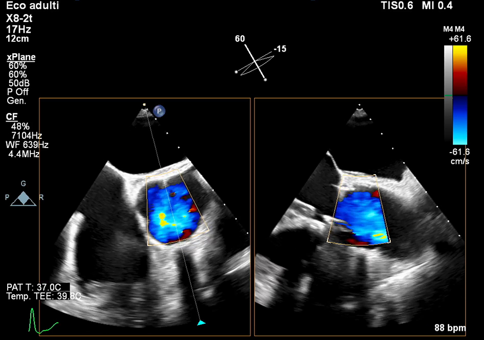 Figure 5