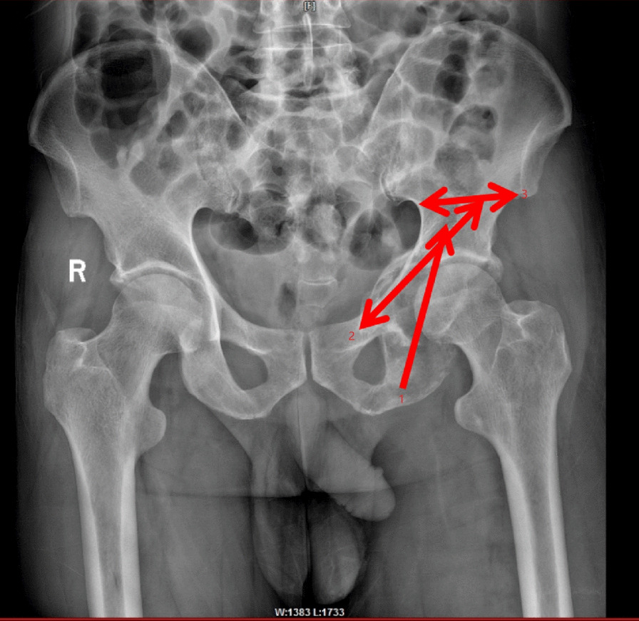 Figure 2