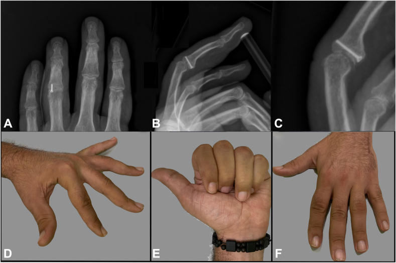 Figure 6