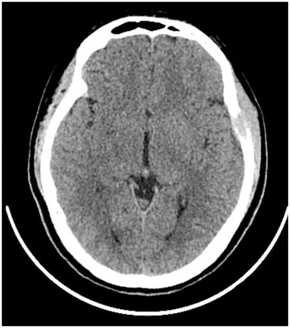 Figure 1