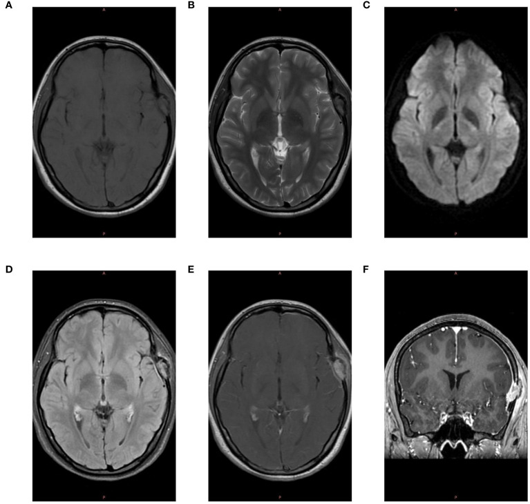 Figure 2