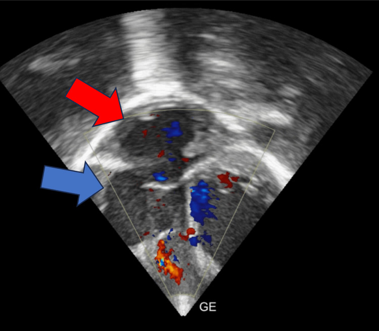 Figure 4