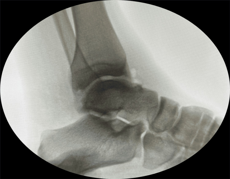 Figure 6