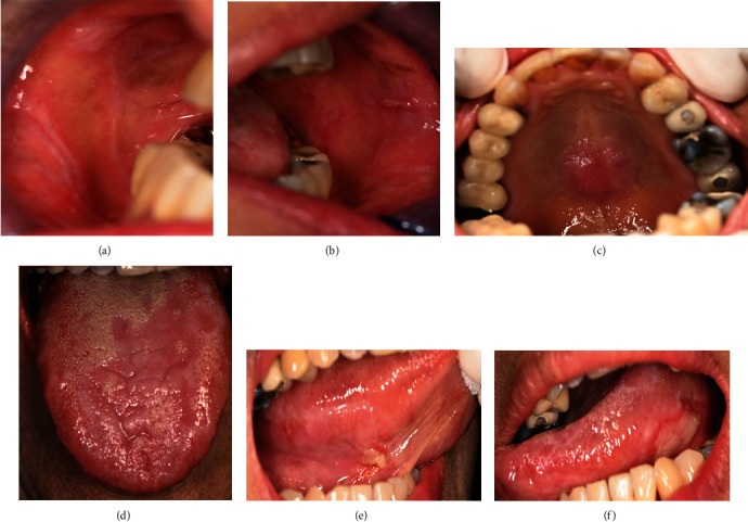 Figure 2