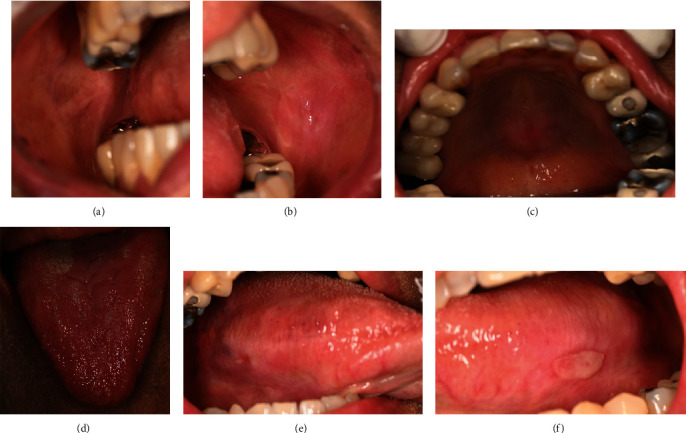 Figure 4