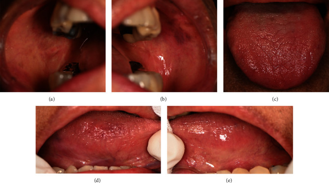 Figure 5
