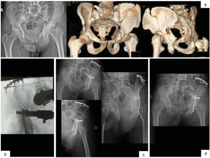 Fig. 3