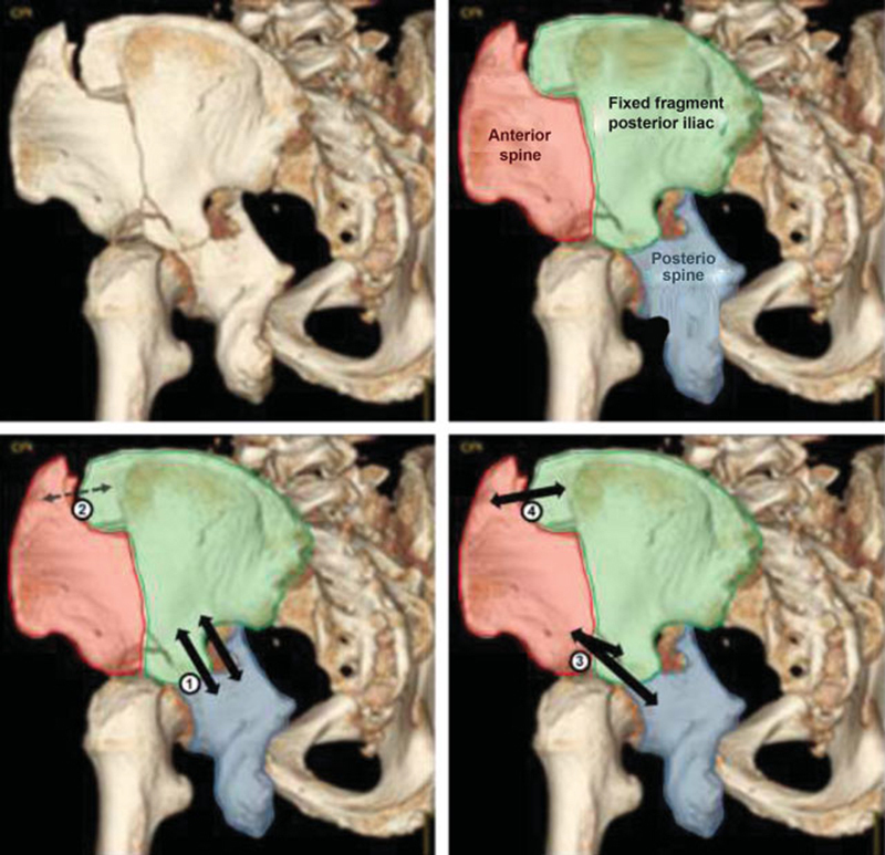 Fig. 5