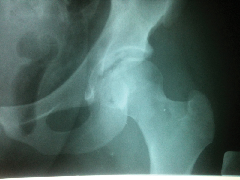 Fig. 1