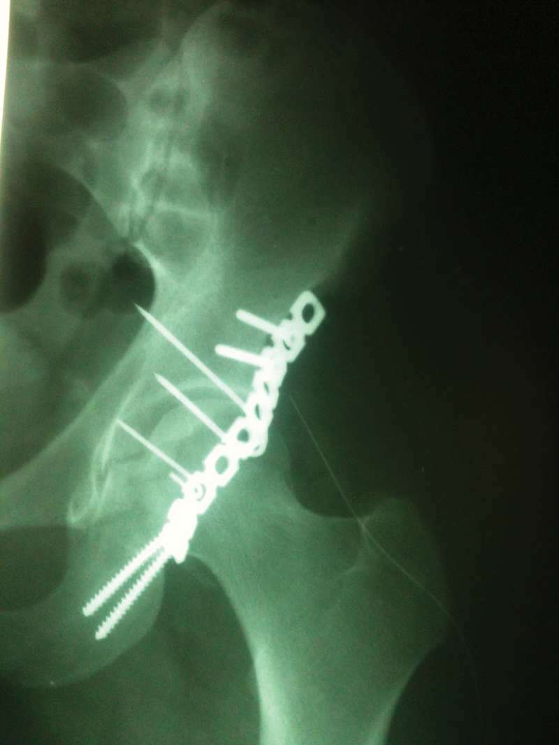 Fig. 3