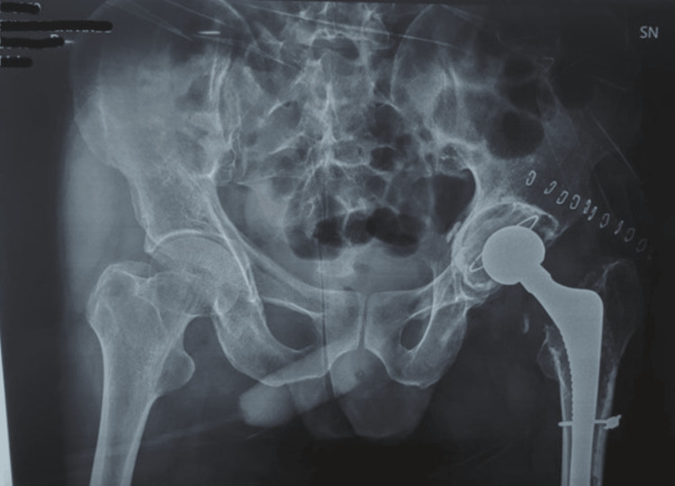 Figure 12