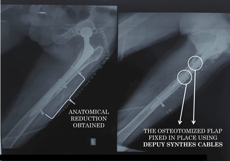 Figure 13