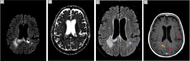 Fig. 2