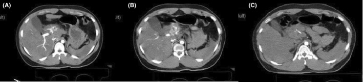 FIGURE 1