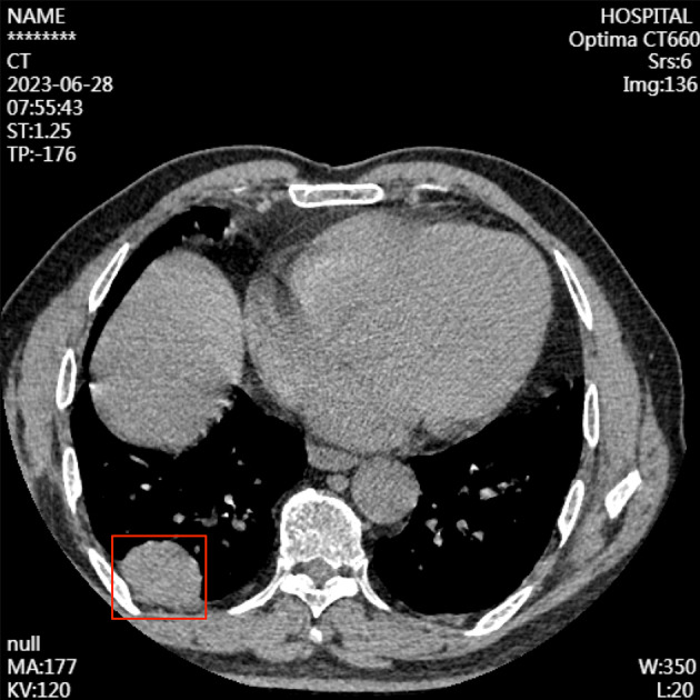 FIGURE 1