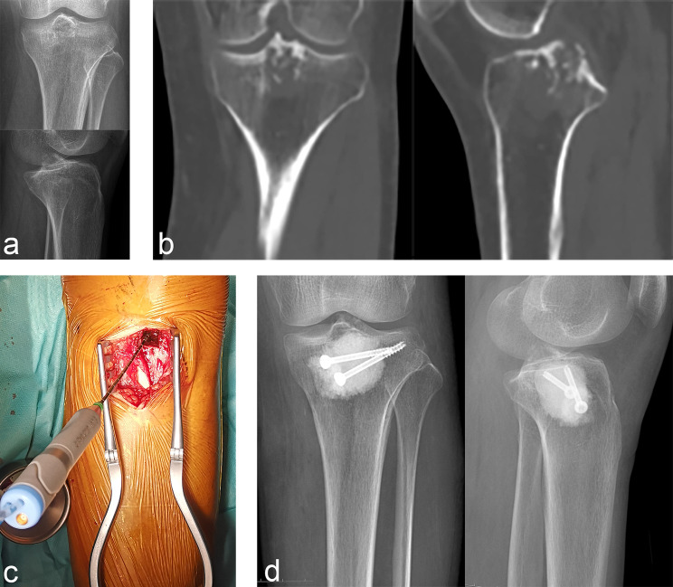 Figure 4
