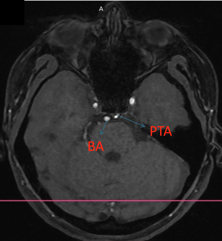 Figure 5
