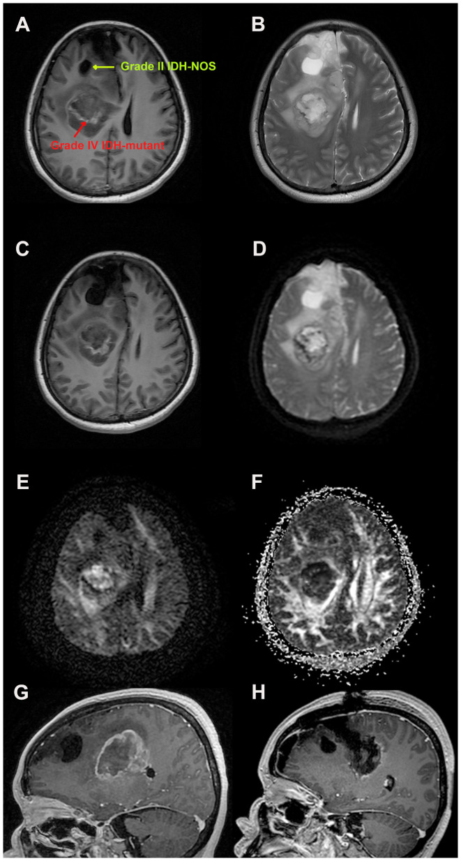 Figure 1
