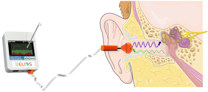 Figure 2