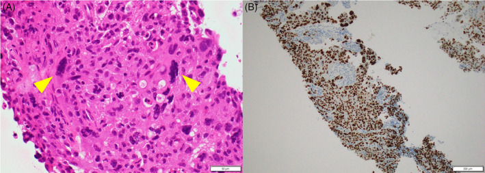 FIGURE 2