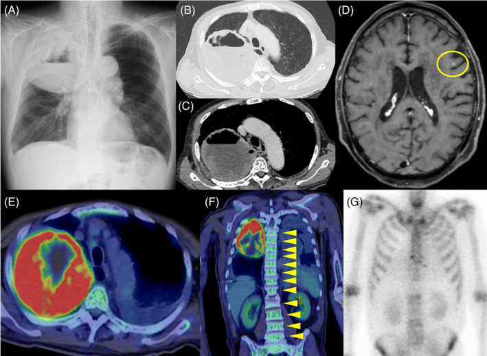FIGURE 1