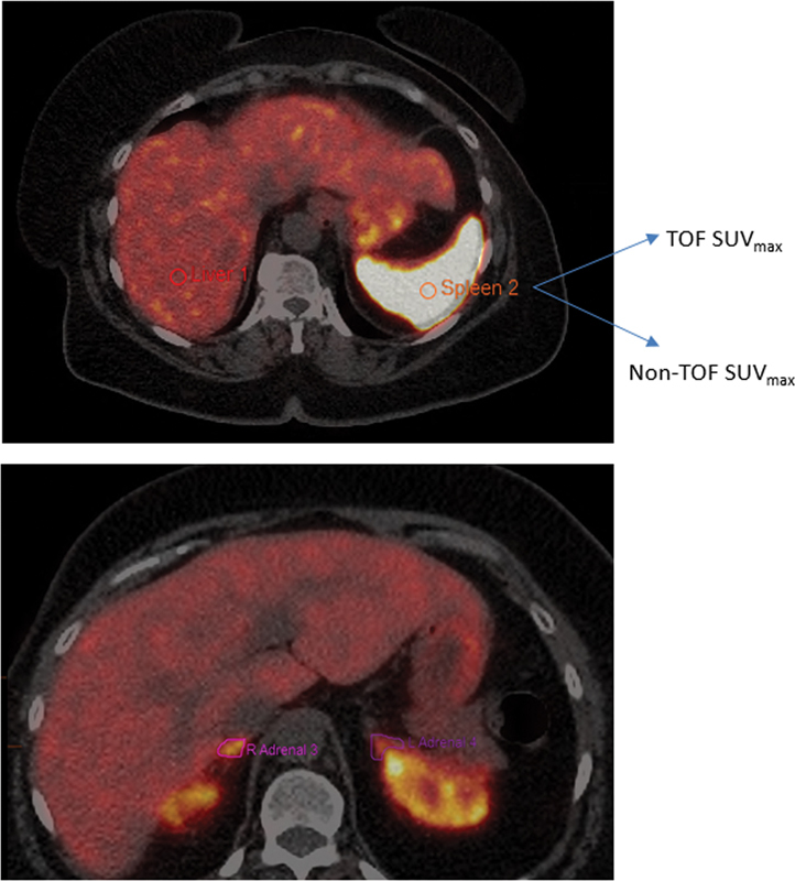 Fig. 2