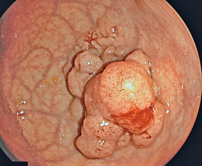 Fig. 2