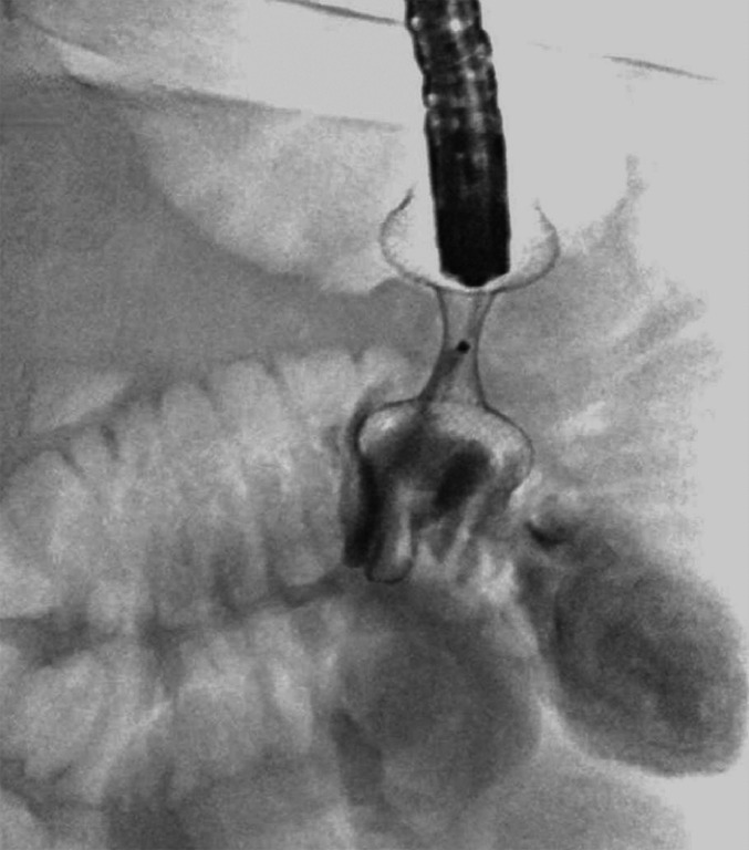 Fig. 5