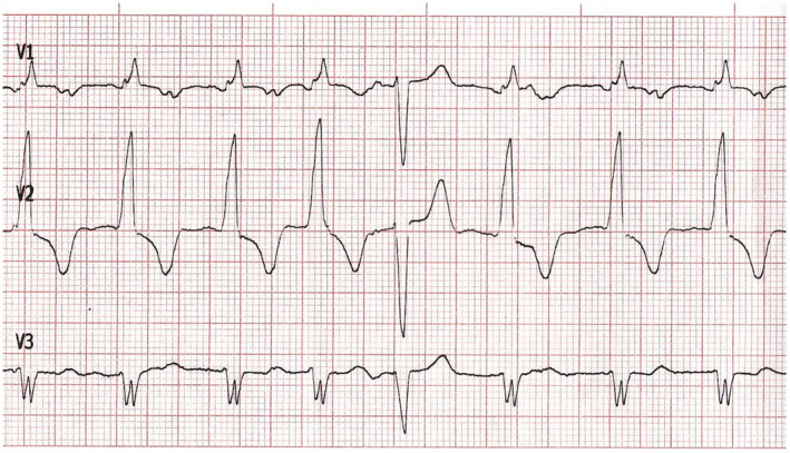 FIGURE 1