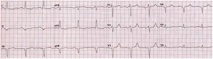 FIGURE 3