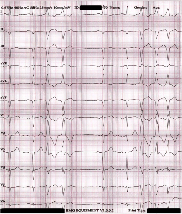 FIGURE 2