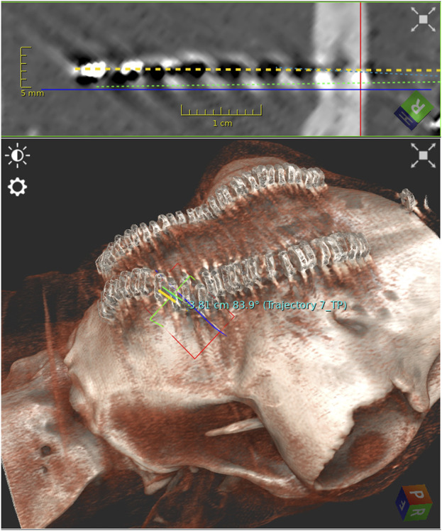 FIGURE 2