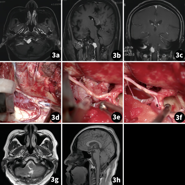 Figure 3