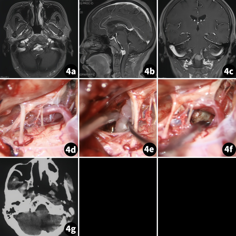 Figure 4