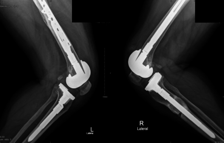 Figure 10