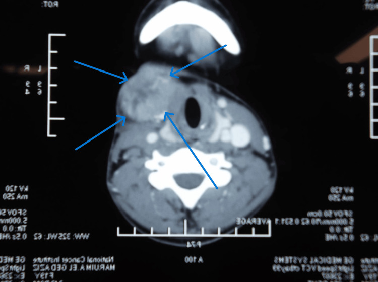 Figure 9