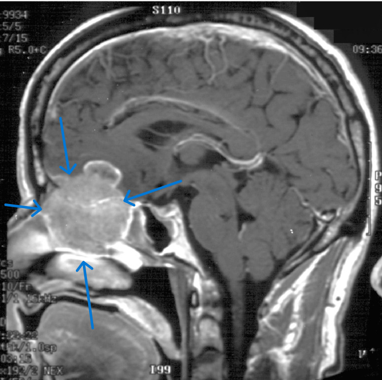 Figure 10