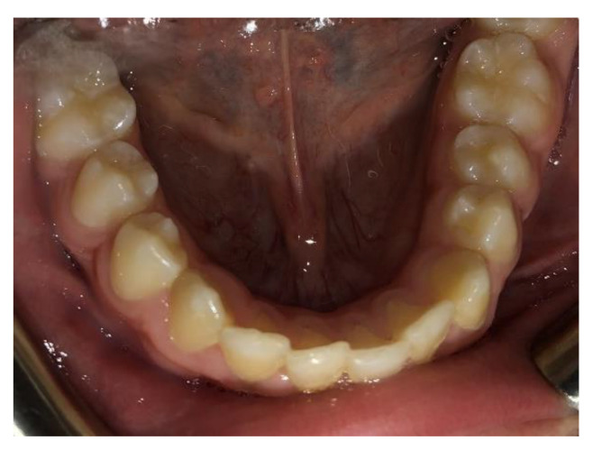 Figure 9