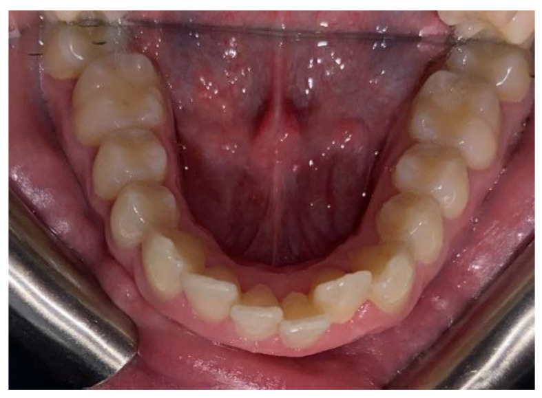 Figure 11