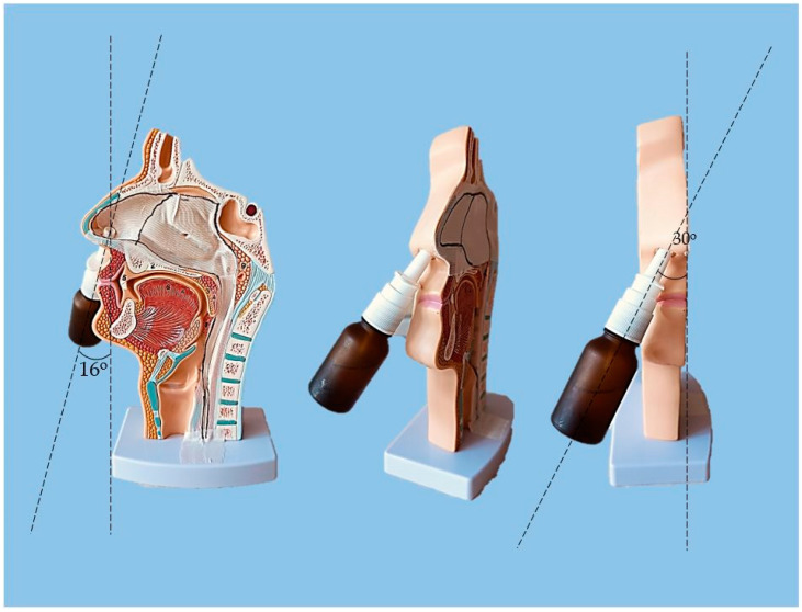 Figure 11