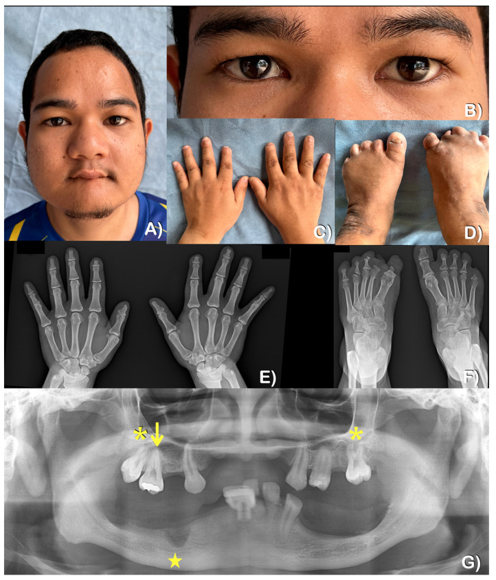 Figure 5