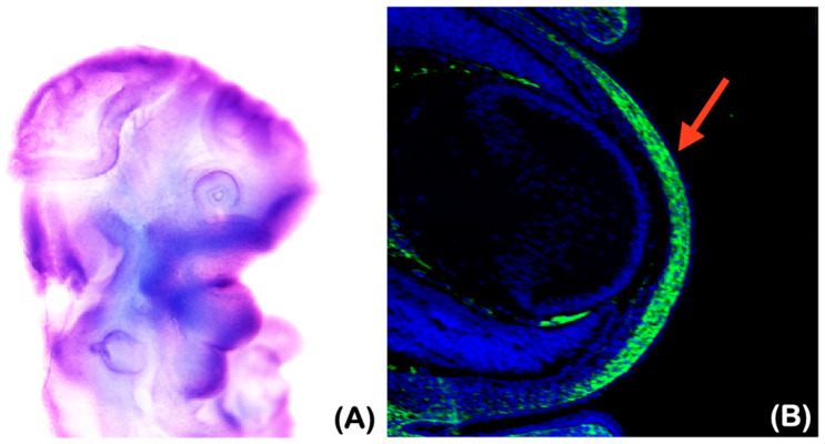 Figure 11