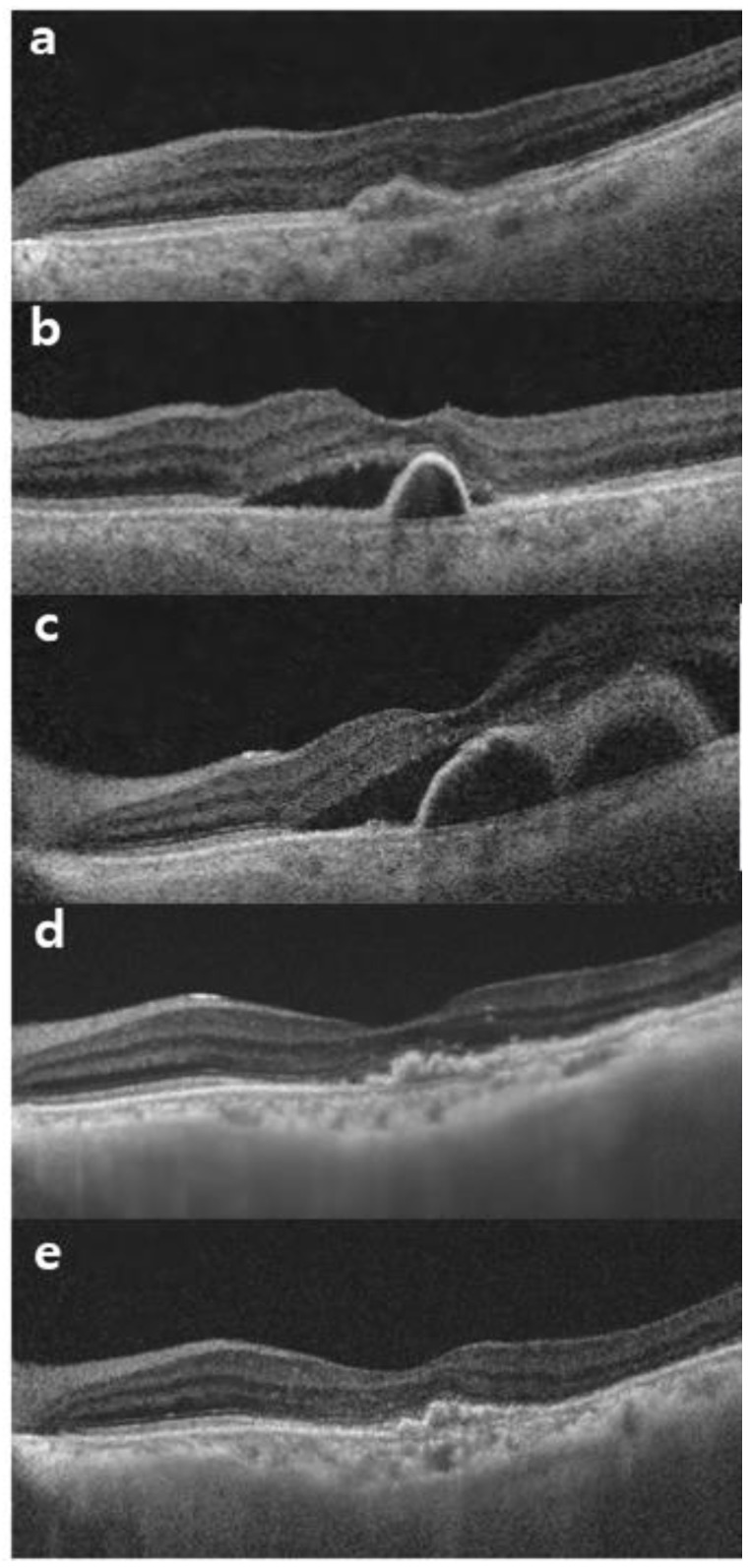 Figure 4