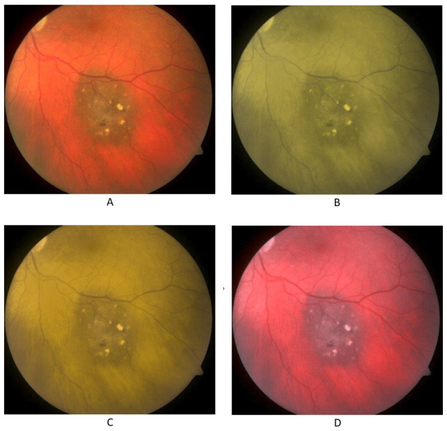 Figure 2