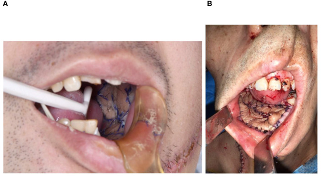 Figure 3